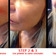 Khuraira Cosmetics Dark Circle Primer Remove Botox Bruise Around Lips