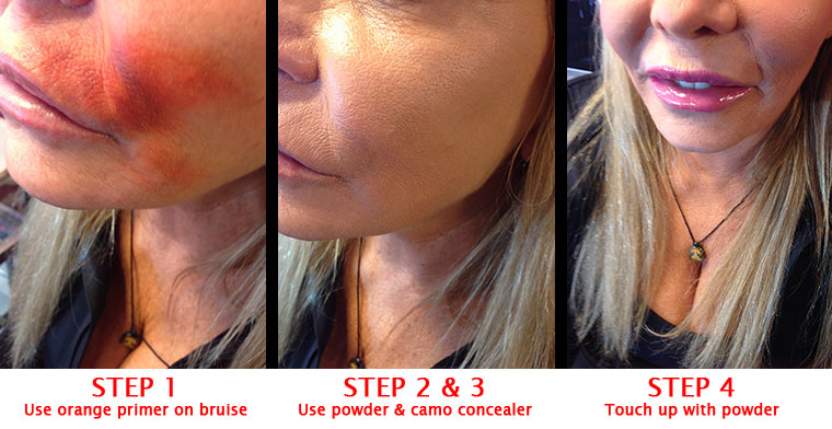 Khuraira Cosmetics Dark Circle Primer Remove Botox Bruise Around Lips